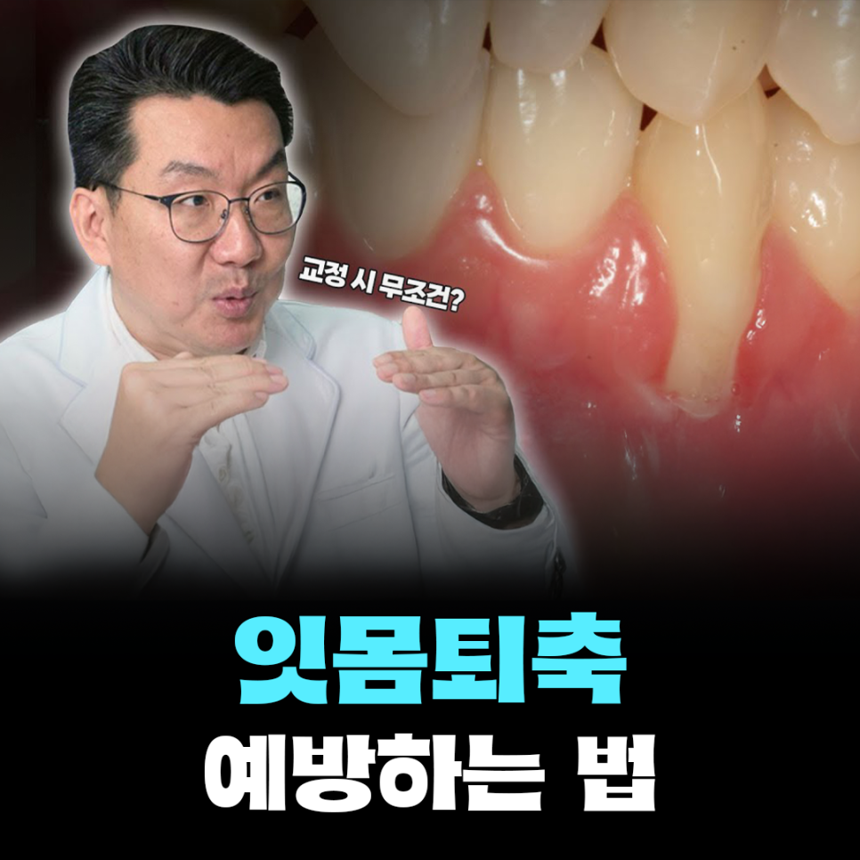 치아교정 중 잇몸 내려앉는 현상? 잇몸퇴축 발생 원인과 예방법 관련 이미지 1