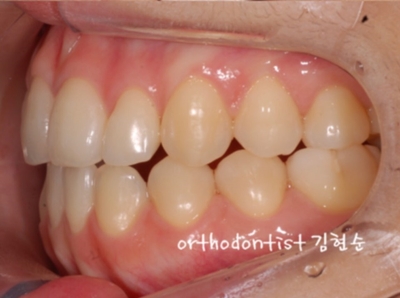 강남교정치과 관련 이미지 35