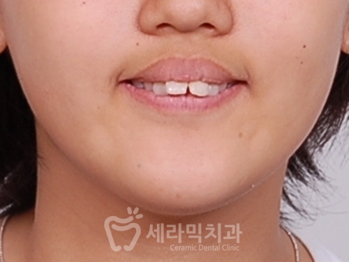 우리 아이 관련 이미지 3