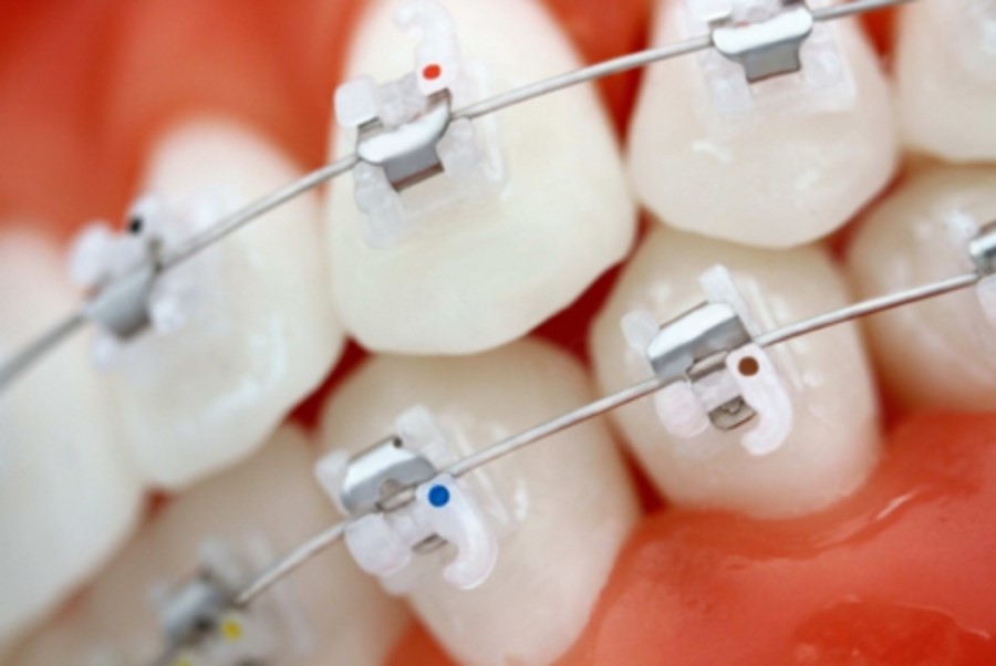 클리피씨 비용 기간단축 관련 이미지 12