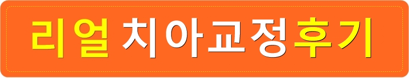 치아교정전후, 돌출입치아교정으로 변화한 얼굴! 관련 이미지 3