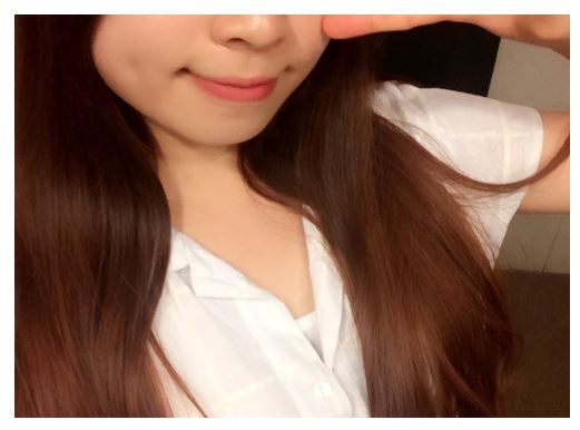 세라믹치과 홍수빈님 다시교정하기 관련 이미지 2