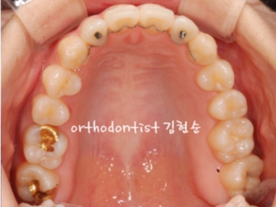강남교정치과 관련 이미지 20