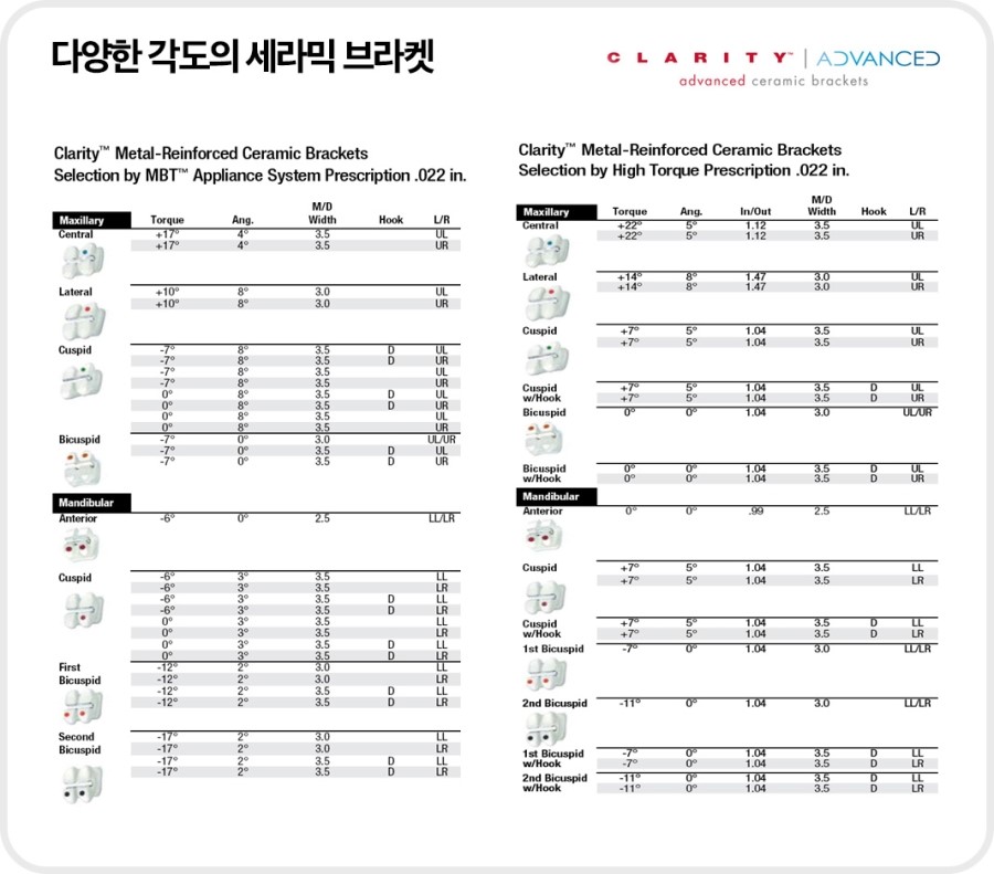 치아각도 교정과정 관련 이미지 2