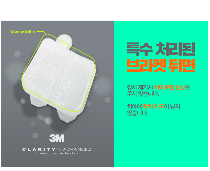세라믹교정 3M  치아교정 모델 신청 ~ 관련 이미지 8