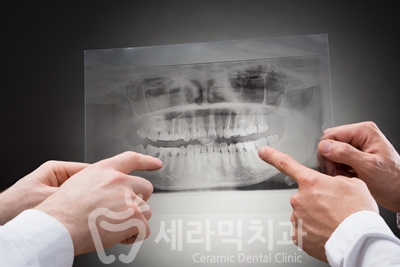 치아교정 부작용, 결과 불만족 고민 해결사, 세라믹치과 관련 이미지 15