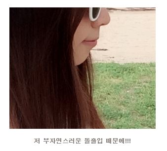 세라믹치과 홍수빈님 다시교정하기 관련 이미지 4