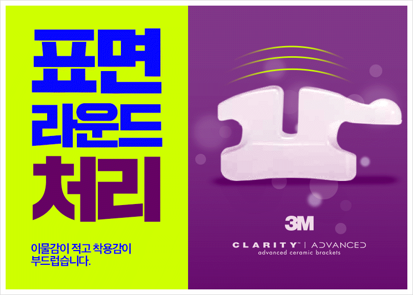 세라믹교정 단점을 보안한 클래러티 어드밴스 ~ 관련 이미지 8