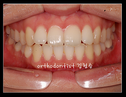 강남교정치과 관련 이미지 27