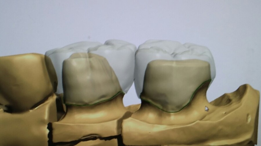 [미소가아름다운치과 양재유]  디지털 기공소 운영 관련 이미지 11