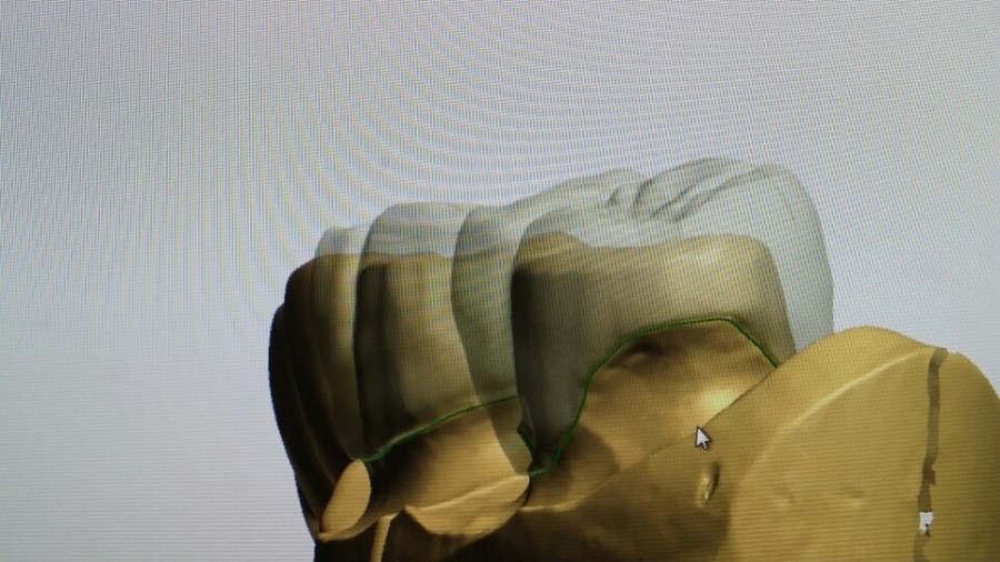 [미소가아름다운치과 양재유]  디지털 기공소 운영 관련 이미지 12