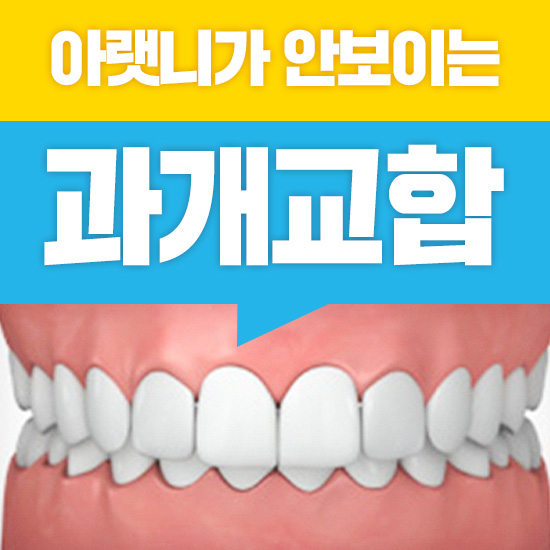 과개교합 무턱 개선 관련 이미지 1