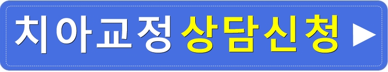 치아교정전후, 돌출입치아교정으로 변화한 얼굴! 관련 이미지 4