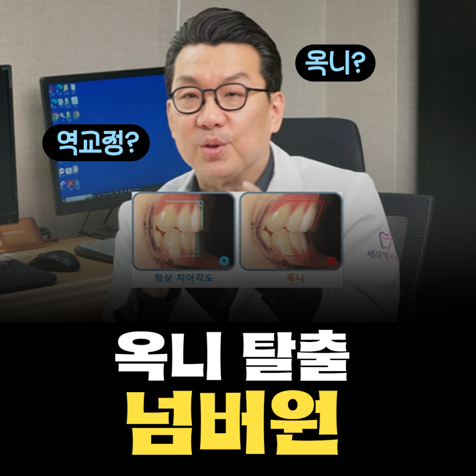 '옥니 역교정' 의미, 치료법, 부작용 알아보기 (+교정치과 선택 Tip) 관련 이미지 1
