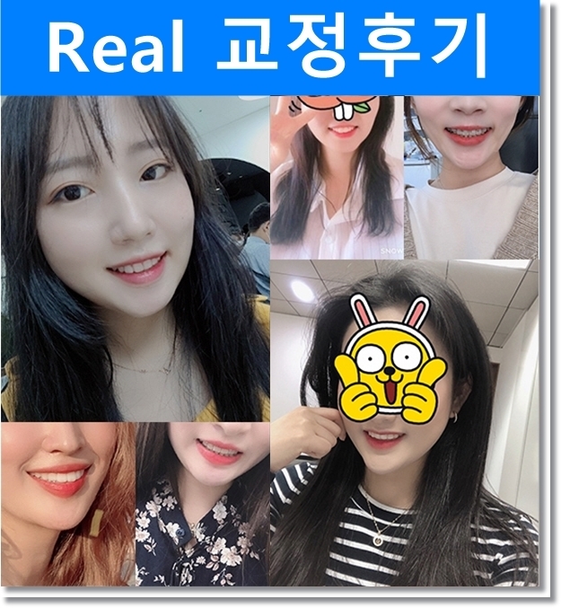 성공적인 치아교정은 치아교정 전문의에게! 관련 이미지 5