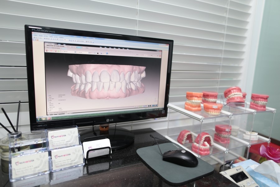 세라믹교정 미국3M 클라리티 관련 이미지 4