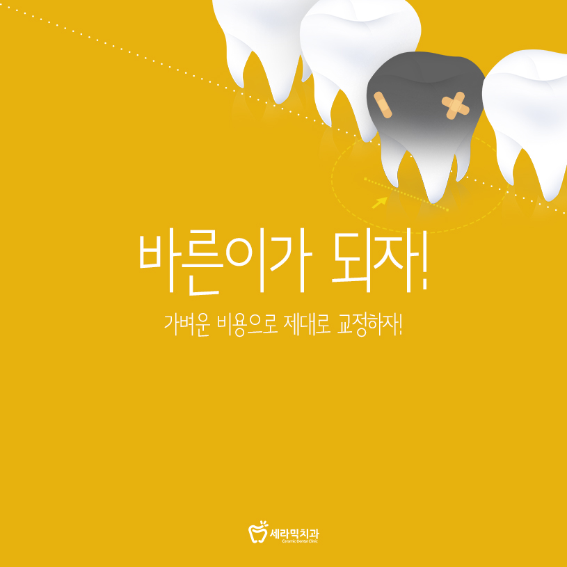 발치교정 부작용 옥니 해결법 관련 이미지 1