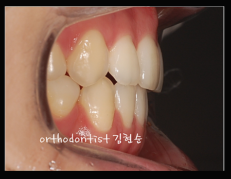 강남교정치과 관련 이미지 30