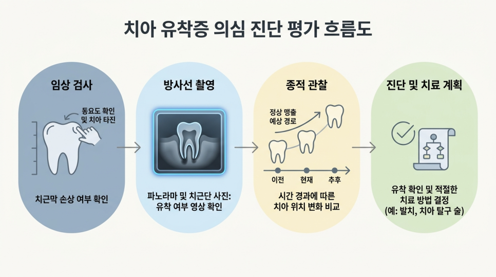 치아 유착(ankylosis)이란? 아이 유치가 안 빠지고 낮게 보일 때 확인할 점 관련 이미지 7