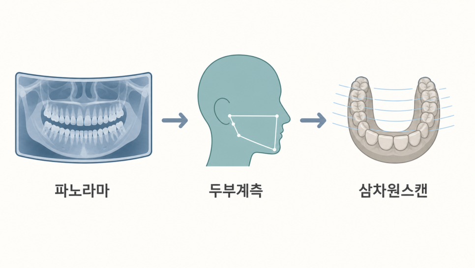 Treatment for Missing Teeth: Is an Implant the Only Answer? When Orthodontics Can Resolve the Space image 5