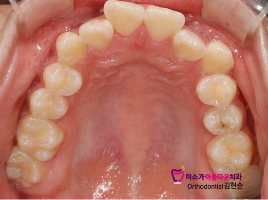논현동교정잘하는치과 미소가아름다운치과 고객님 후기입니다 관련 이미지 3