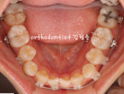 강남교정치과 관련 이미지 21