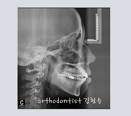 강남교정치과 관련 이미지 9