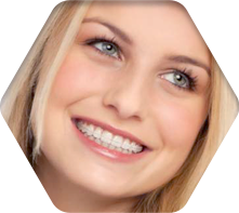 세라믹교정 세라믹치과 세밀하고 정확하게! 더 아름답고 건강한 치아를 만듭니다. 관련 이미지 5