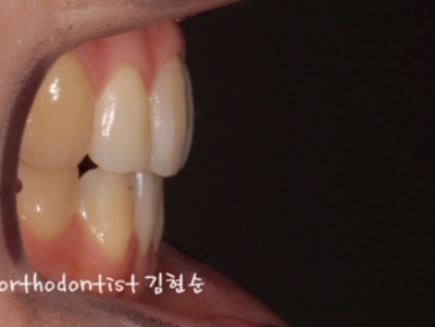 강남교정치과 관련 이미지 17
