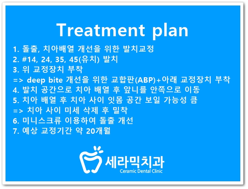 돌출입교정, 심미성과 치아 건강을 동시에 해결! 관련 이미지 16