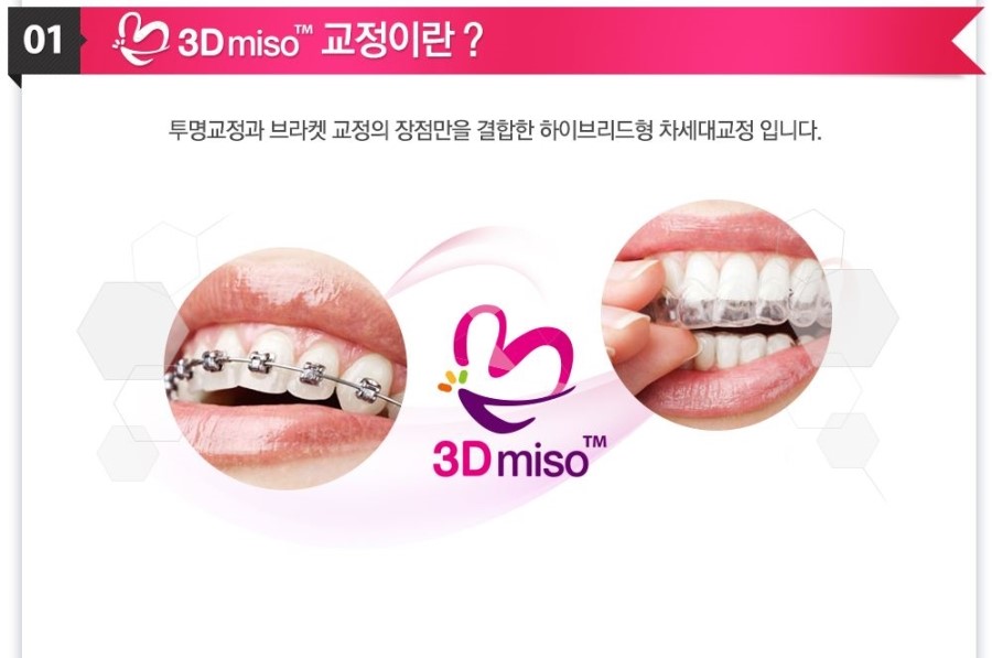 [ 학동역 치과 ] 투명교정의 새이름 3D miso 교정 관련 이미지 3