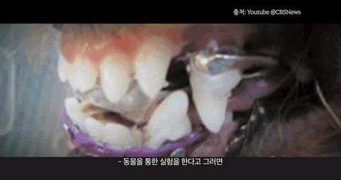 돌출입 교정 기간은 얼마나 걸릴까? 관련 이미지 6