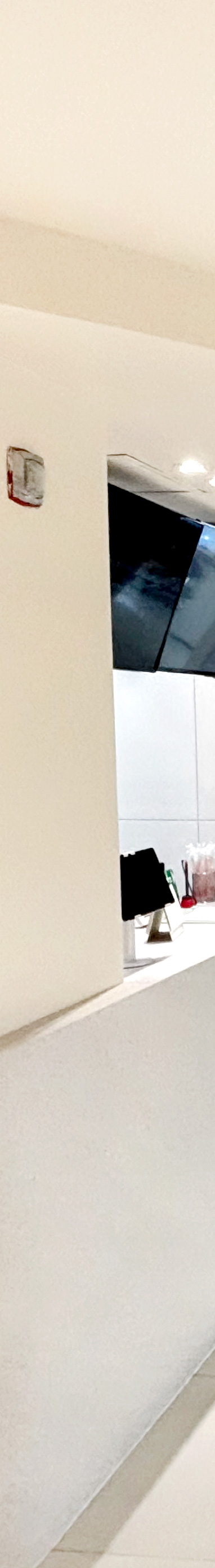 20대 돌출입교정, 무턱교정, 치아교정전후 세련된 얼굴 라인을 되찾다! 관련 이미지 15