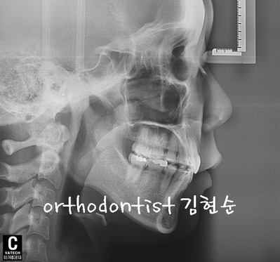 강남 돌출 관련 이미지 32