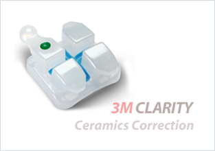 세라믹교정 세라믹치과 세밀하고 정확하게! 더 아름답고 건강한 치아를 만듭니다. 관련 이미지 6