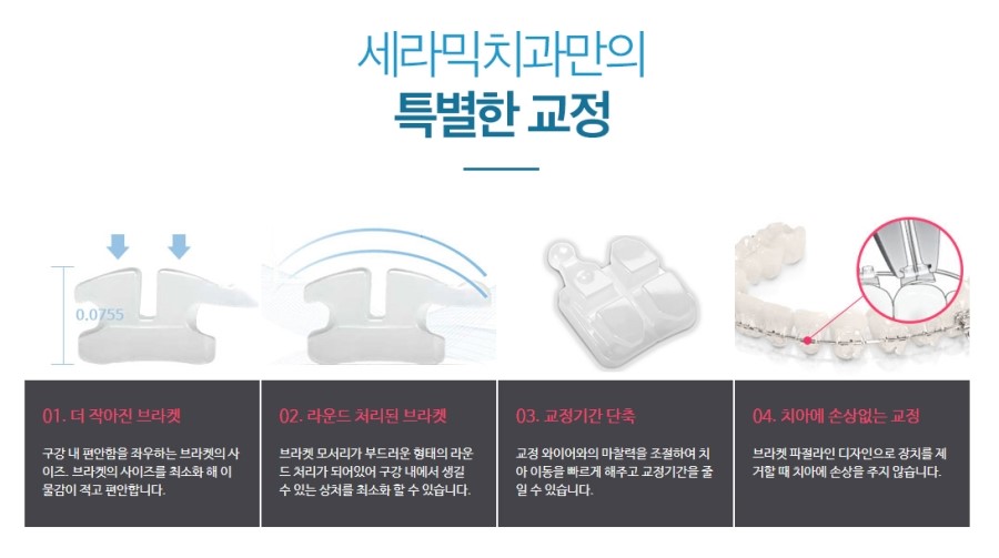 세라믹교정, 모르겠다면 이곳을 클릭 관련 이미지 6