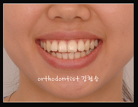 강남교정치과 관련 이미지 31