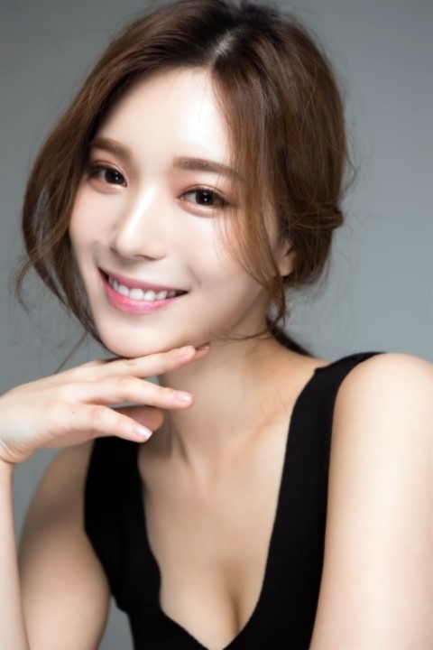 세라믹치과 학동역치과 페레로로쉐 정지연님 광고 관련 이미지 6