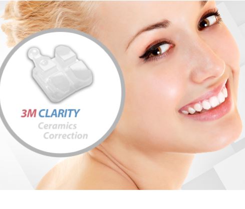 세라믹교정  세라믹치과 [ Ceramic Dental Clinic ] 관련 이미지 1