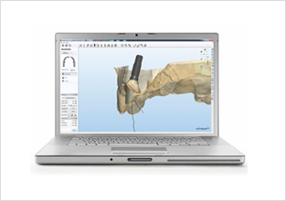 세라믹교정 세라믹치과  "투명교정"의 새이름 "3D미소교정" 관련 이미지 4