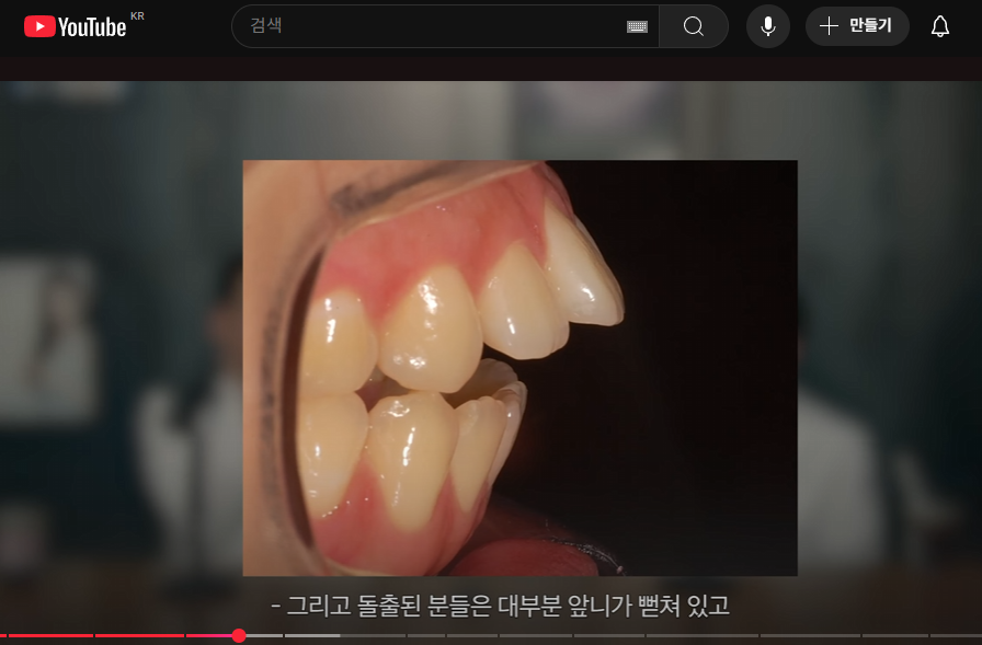 학동역치과 성인 돌출입교정, 비수술 · 비발치 고민하고 있다면 관련 이미지 3