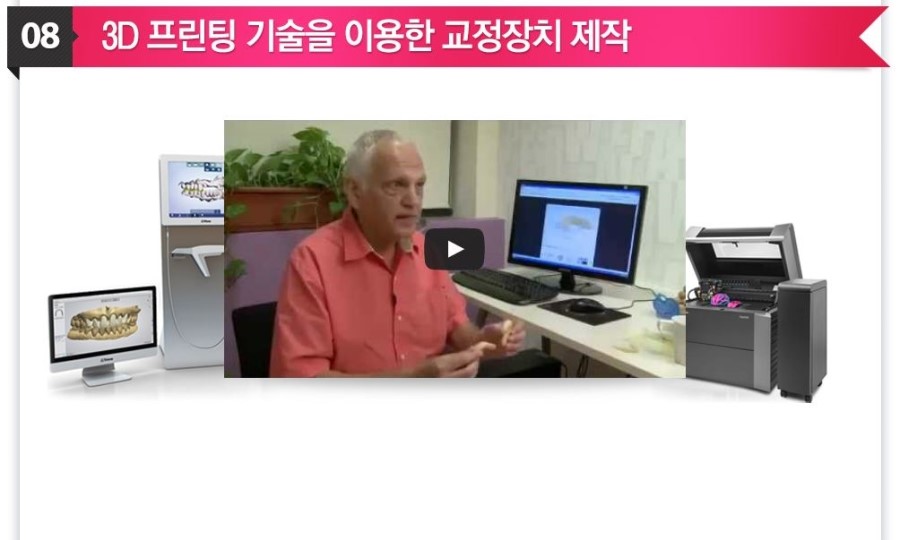 [ 학동역 치과 ] 투명교정의 새이름 3D miso 교정 관련 이미지 10