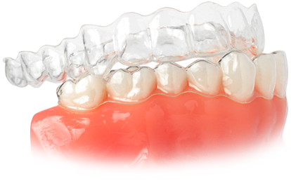 학동역치과 세라믹치과 앞니투명교정 관련 이미지 2
