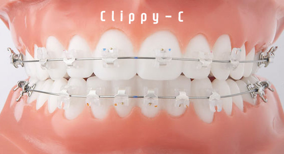 학동역치과 치아교정 잘하는 곳 ! 관련 이미지 7