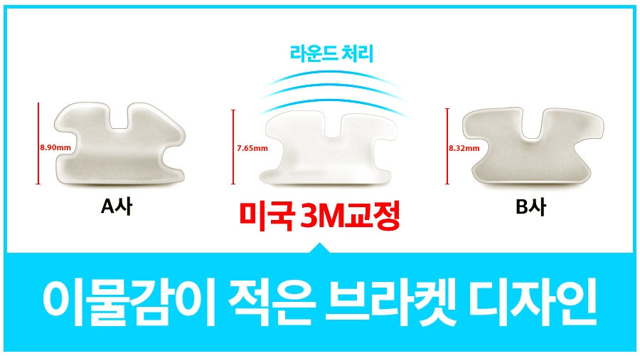 세라믹치과 돌출입교정은 미국3M 치아교정으로 관련 이미지 4