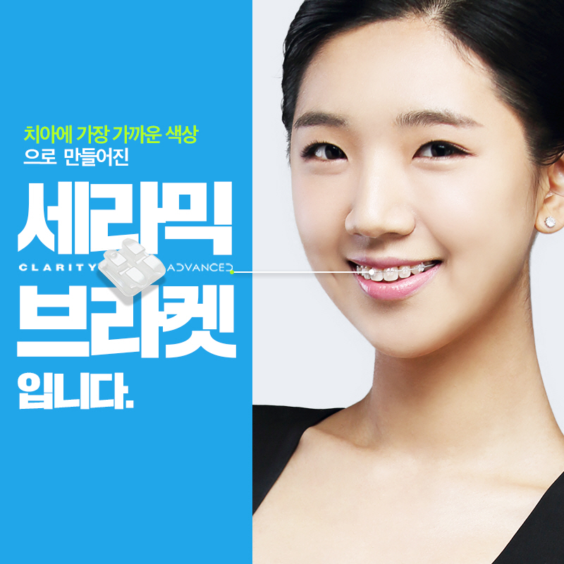 학동역 치아교정 3M 클래러티 어드밴스 관련 이미지 2