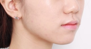 3D 스캐너를 이용한 교정 심뮬레이션 관련 이미지 3