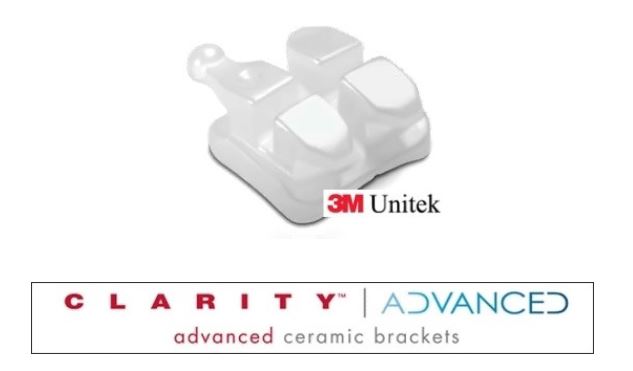 세라믹교정 장점 관련 이미지 3