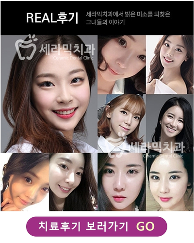 강남 세라믹 치아교정 잘하는곳, 세라믹치과 관련 이미지 6
