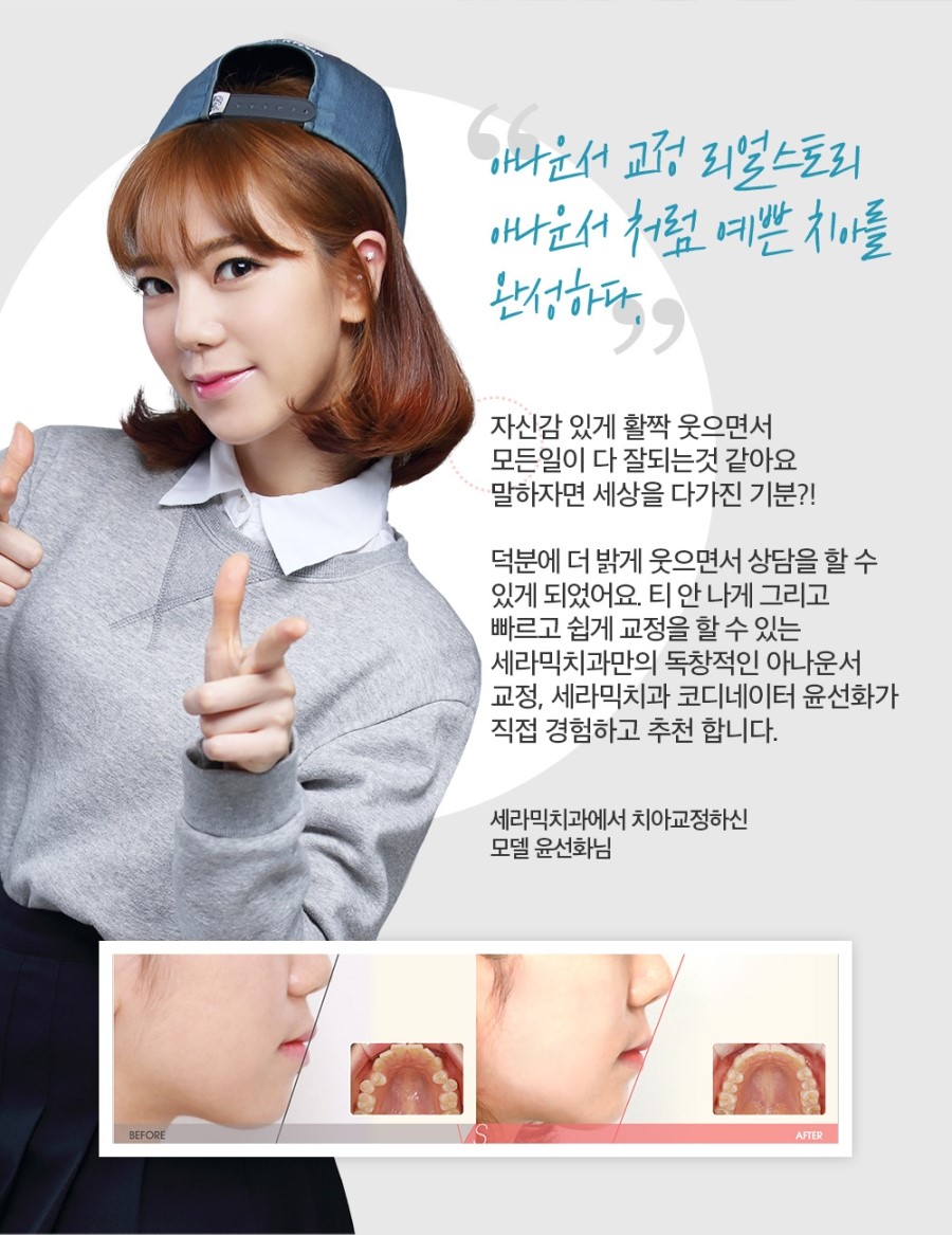 세라믹교정 이벤트 관련 이미지 11